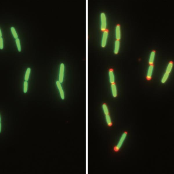 Shrinking to survive: Bacteria adapt to a lifestyle in flux