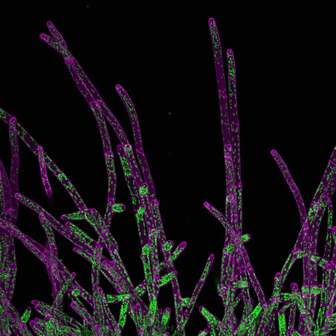 cells on the edge of the moss colony that are spreading. In green is autofluorescence of chlorophyll in chloroplasts and ion magenta its cell wall stained with calcofluor white. By Ivan Radin